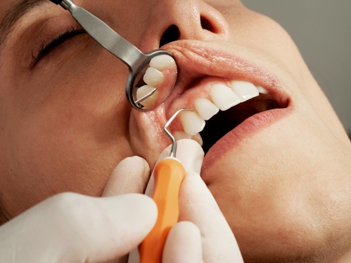 Cosmetic Dentistry in Manassas
