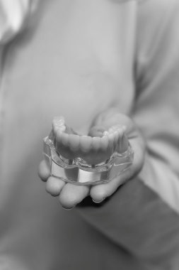 Dental Crowns and Bridges