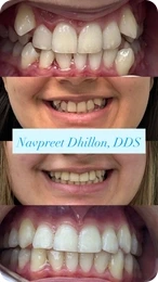 Smile gallery photo